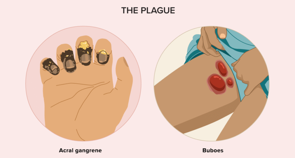 Bubonic Plague 2025 | Allfactshub.sbs